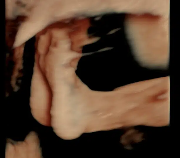 185_24.png 3d fødder baby