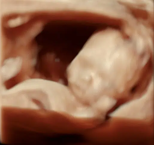 185_8.png 3d ansigt  og mave baby
