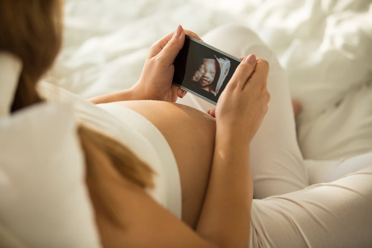 Pregnant woman looking at 3D ultrasound photo of her baby Gravid kvinde ser på 3D ultralydsbillede af sit barn på telefonen.