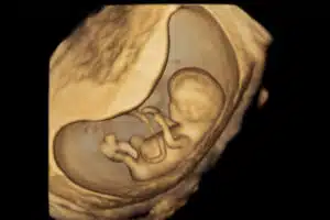 3D-ultralydsscanning af et foster i livmoderen under en tidlig graviditet.