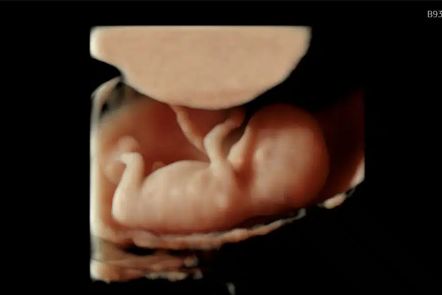 Tidlig 3D scanning