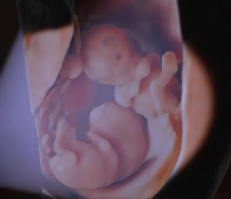 3D ultralyd af foster, der viser to babyer under tidlig graviditetsscanning.