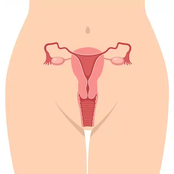 livmoder.jpg Illustration af en kvindes livmoder