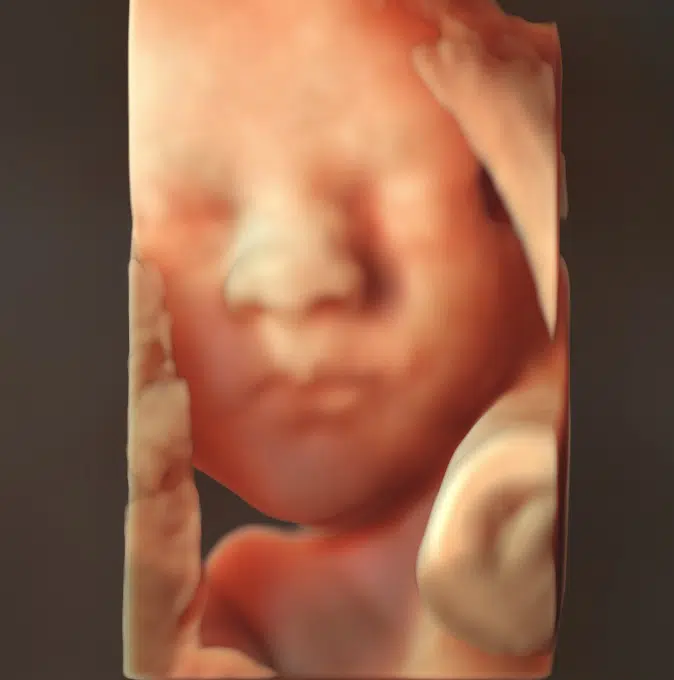 3D ultralydsscanning af babyens ansigt fra 14+0 til fødslen hos Praksis Jordemoder