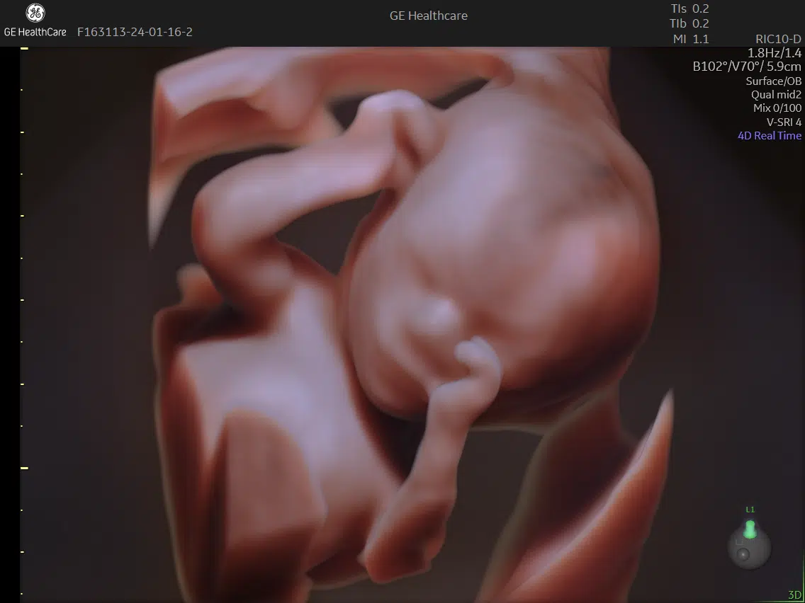 praksis-jordemoder_3.png 3d ansigt og hænder baby