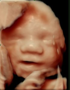 Sen tryghedsscanning uge 29, 3D