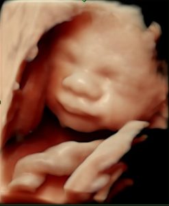 Sen tryghedsscanning uge 29, 3D