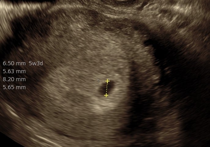 Tryghedsscanning uge 5,3