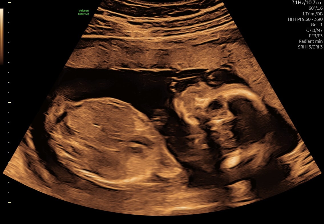 Tryghedsscanning fra uge 14