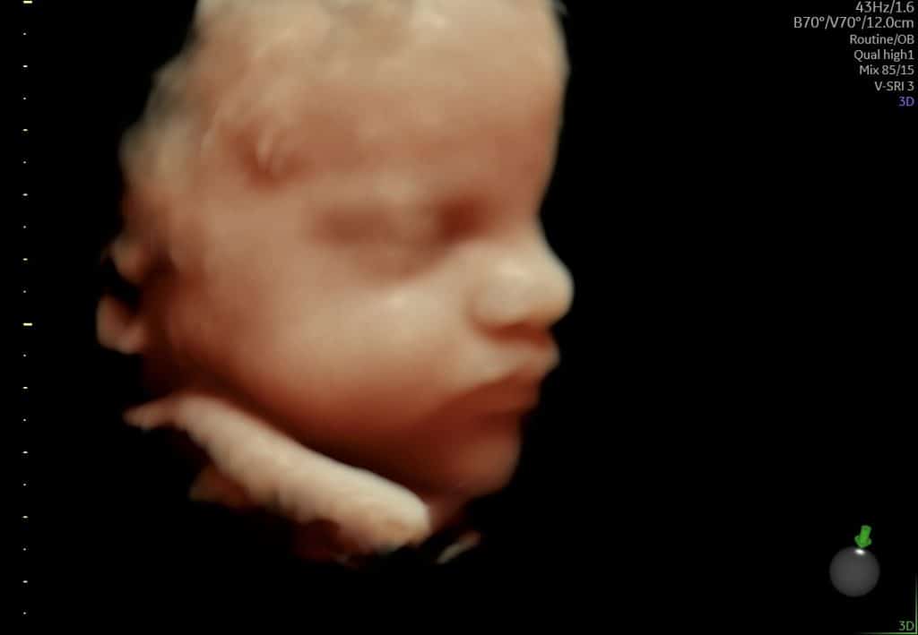 Ultralyd 3D ansigt uge 30