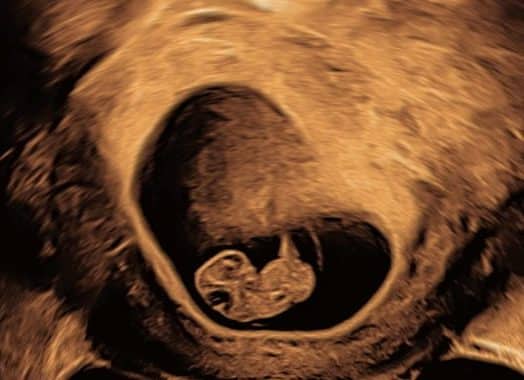 Graviditetsscanning hos Praksisjordemoder
