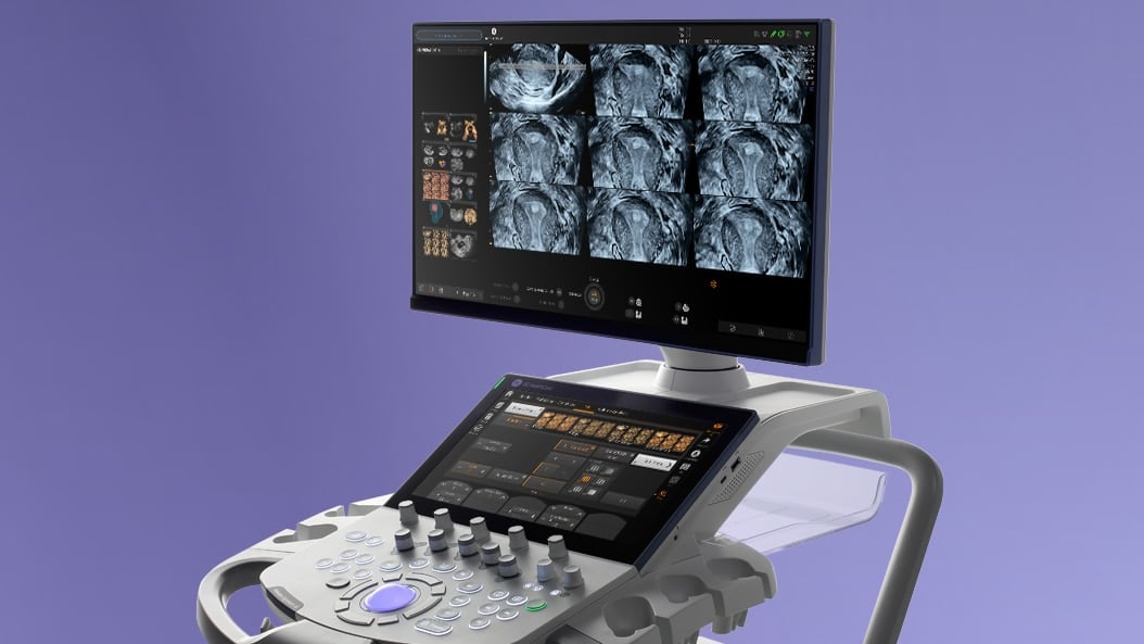 GE Voluson Signature 18 ultralydsscanner